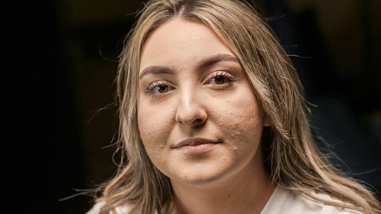 Zdraví pleti a prevence akné